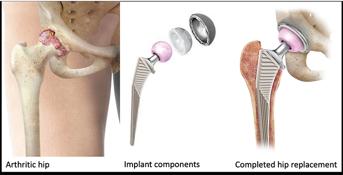 best Orthopedic Surgeon in Lucknow