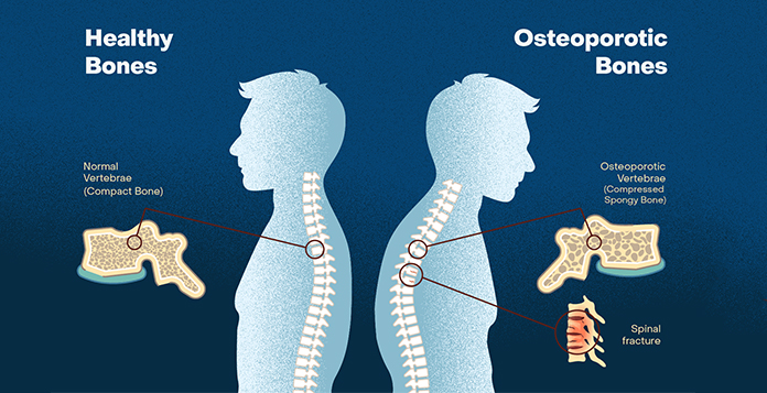 best Orthopedic Surgeon in Lucknow