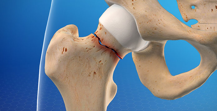 best Orthopedic Surgeon in Lucknow