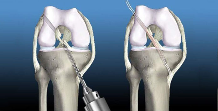 best Orthopedic Surgeon in Lucknow