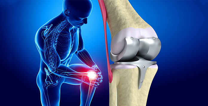 best Orthopedic Surgeon in Lucknow